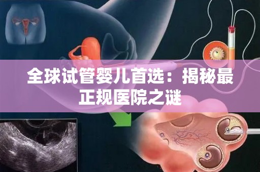 全球试管婴儿首选：揭秘最正规医院之谜