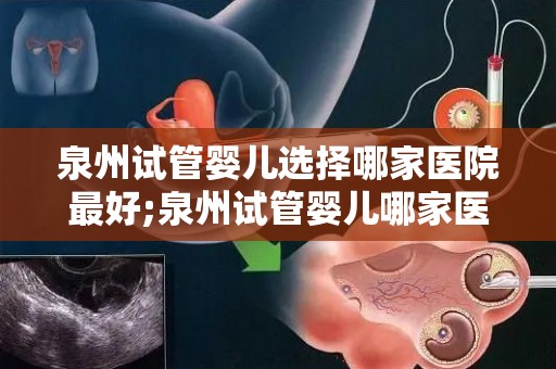 泉州试管婴儿选择哪家医院最好;泉州试管婴儿哪家医院最佳？权威推荐揭晓