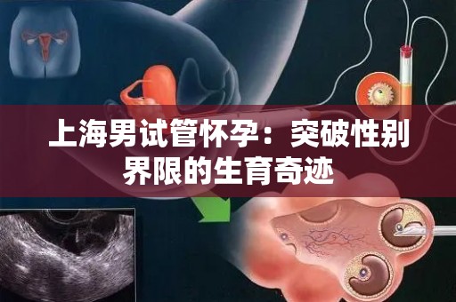 上海男试管怀孕：突破性别界限的生育奇迹