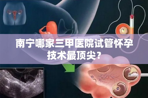 南宁哪家三甲医院试管怀孕技术最顶尖? 南宁哪家三甲医院试管怀孕技术最顶尖?