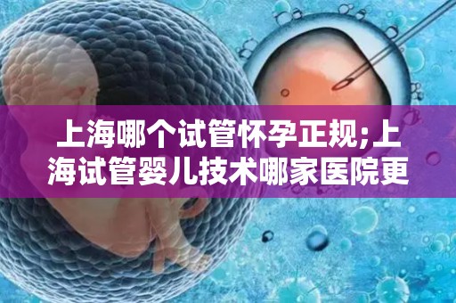 上海哪个试管怀孕正规;上海试管婴儿技术哪家医院更正规? 上海哪个试管怀孕正规;上海试管婴儿技术哪家医院更正规?