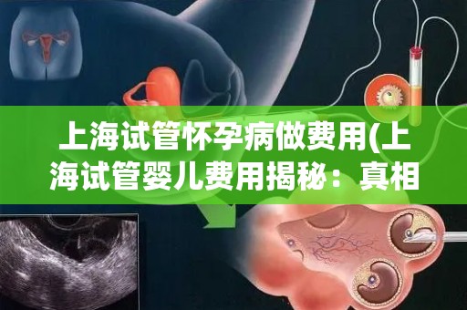 上海试管怀孕病做费用(上海试管婴儿费用揭秘:真相令人咋舌) 上海试管怀孕病做费用(上海试管婴儿费用揭秘:真相令人咋舌)