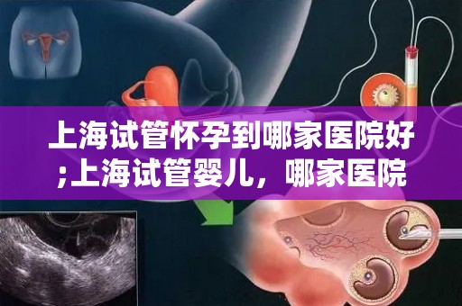上海试管怀孕到哪家医院好;上海试管婴儿，哪家医院最靠谱？