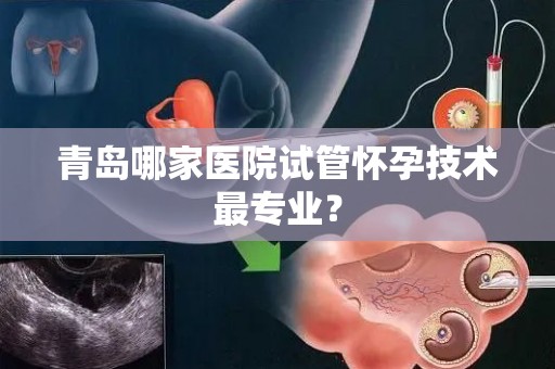 青岛哪家医院试管怀孕技术最专业？