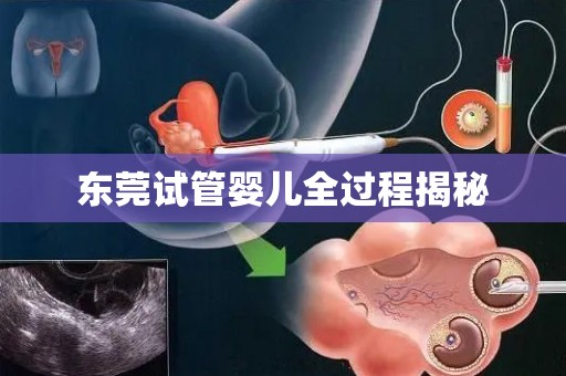 东莞试管婴儿全过程揭秘