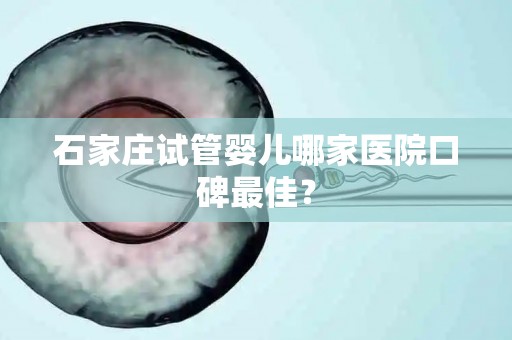石家庄试管婴儿哪家医院口碑最佳? 石家庄试管婴儿哪家医院口碑最佳?