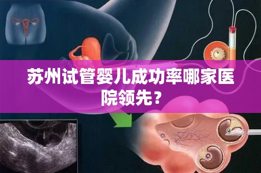 苏州试管婴儿成功率哪家医院领先？
