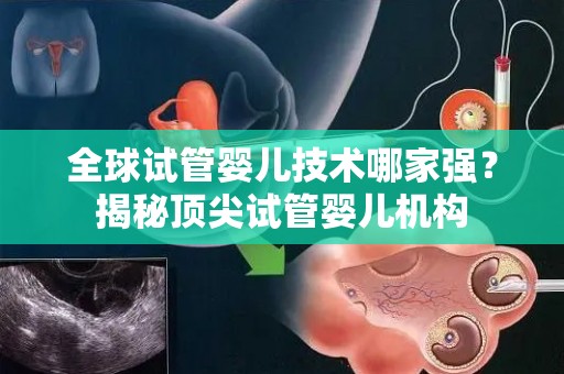 全球试管婴儿技术哪家强？揭秘顶尖试管婴儿机构