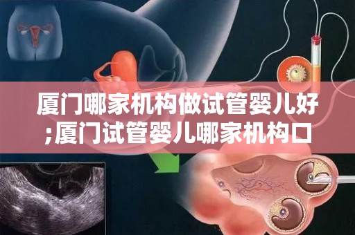 厦门哪家机构做试管婴儿好;厦门试管婴儿哪家机构口碑最佳？