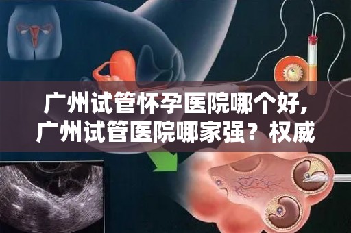 广州试管怀孕医院哪个好,广州试管医院哪家强?权威排名揭晓 广州试管怀孕医院哪个好,广州试管医院哪家强?权威排名揭晓
