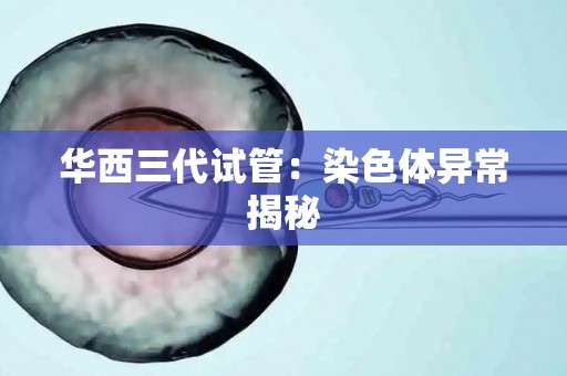 华西三代试管:染色体异常揭秘 华西三代试管:染色体异常揭秘