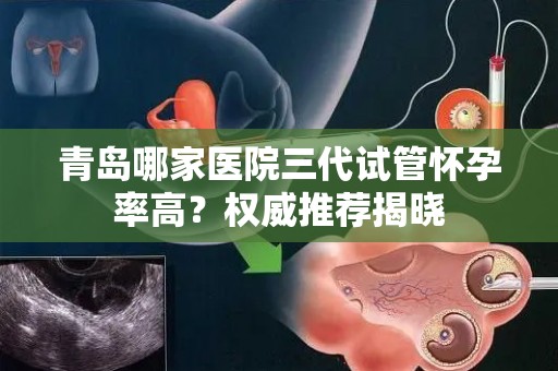 青岛哪家医院三代试管怀孕率高？权威推荐揭晓