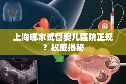 上海哪家试管婴儿医院正规？权威揭秘