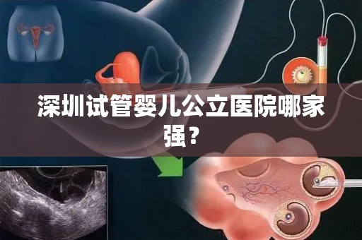 深圳试管婴儿公立医院哪家强？