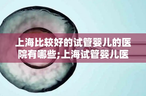 上海比较好的试管婴儿的医院有哪些;上海试管婴儿医院哪家强? 上海比较好的试管婴儿的医院有哪些;上海试管婴儿医院哪家强?