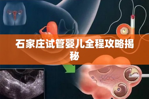 石家庄试管婴儿全程攻略揭秘 石家庄试管婴儿全程攻略揭秘