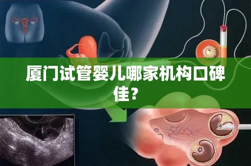 厦门试管婴儿哪家机构口碑佳？