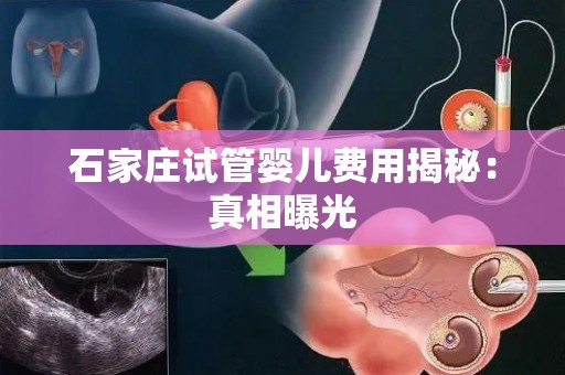 石家庄试管婴儿费用揭秘：真相曝光