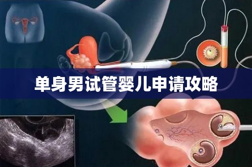 单身男试管婴儿申请攻略