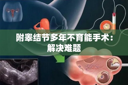 附睾结节多年不育能手术:解决难题 附睾结节多年不育能手术:解决难题