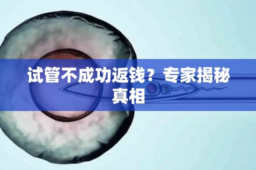 试管不成功返钱?专家揭秘真相 试管不成功返钱?专家揭秘真相