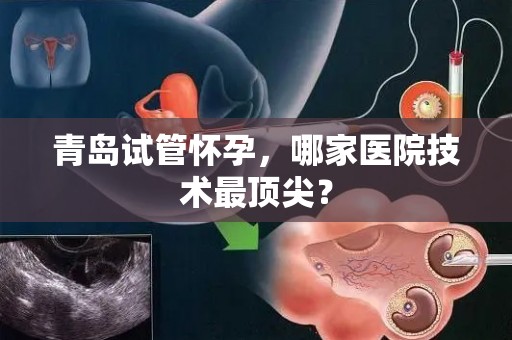 青岛试管怀孕，哪家医院技术最顶尖？
