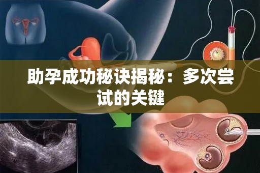 助孕成功秘诀揭秘：多次尝试的关键