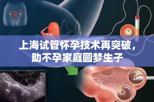 上海试管怀孕技术再突破，助不孕家庭圆梦生孩子