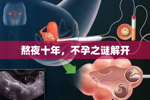 熬夜十年，不孕之谜解开