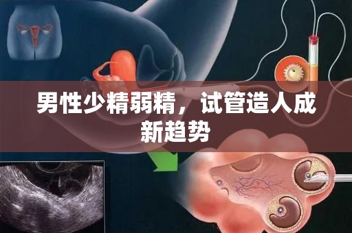 男性少精弱精,试管造人成新趋势 男性少精弱精,试管造人成新趋势