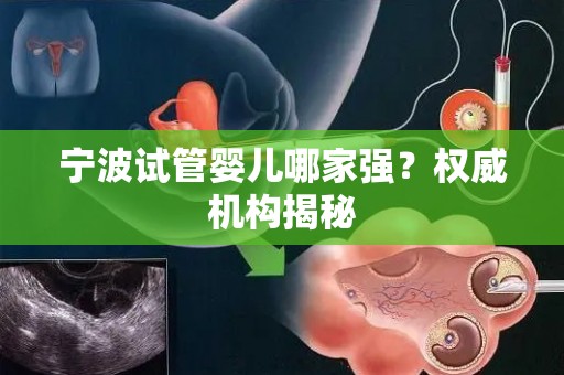宁波试管婴儿哪家强？权威机构揭秘