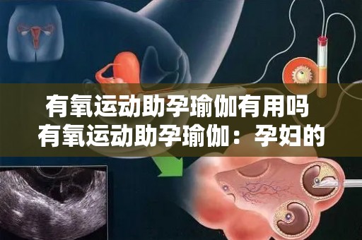 有氧运动助孕瑜伽有用吗 有氧运动助孕瑜伽：孕妇的健康之道