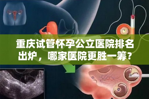 重庆试管怀孕公立医院排名出炉，哪家医院更胜一筹？