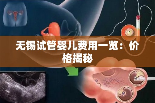 无锡试管婴儿费用一览：价格揭秘
