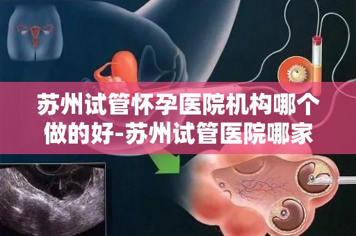 苏州试管怀孕医院机构哪个做的好-苏州试管医院哪家强？权威机构揭秘