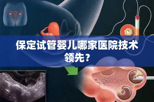 保定试管婴儿哪家医院技术领先？