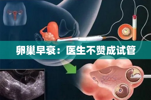 卵巢早衰:医生不赞成试管 卵巢早衰:医生不赞成试管