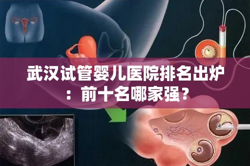 武汉试管婴儿医院排名出炉:前十名哪家强? 武汉试管婴儿医院排名出炉:前十名哪家强?