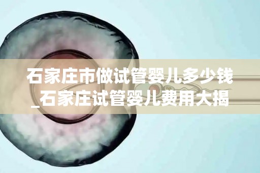 石家庄市做试管婴儿多少钱_石家庄试管婴儿费用大揭秘:价格几何? 石家庄市做试管婴儿多少钱_石家庄试管婴儿费用大揭秘:价格几何?