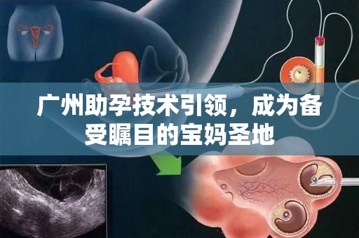 广州助孕技术引领，成为备受瞩目的宝妈圣地