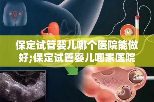 保定试管婴儿哪个医院能做好;保定试管婴儿哪家医院技术领先？