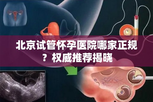 北京试管怀孕医院哪家正规？权威推荐揭晓