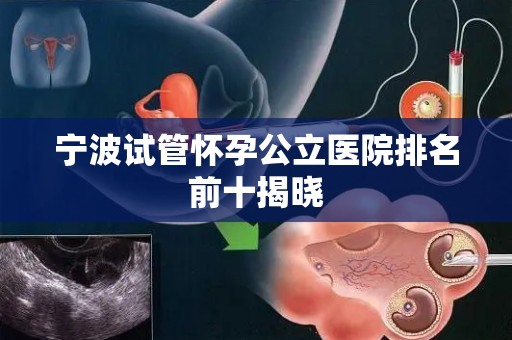 宁波试管怀孕公立医院排名前十揭晓