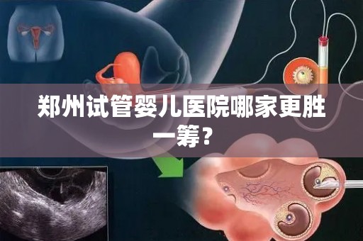 郑州试管婴儿医院哪家更胜一筹? 郑州试管婴儿医院哪家更胜一筹?