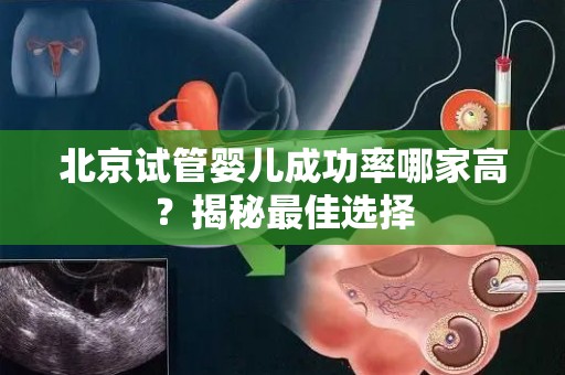 北京试管婴儿成功率哪家高？揭秘最佳选择
