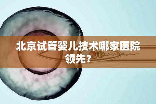 北京试管婴儿技术哪家医院领先？