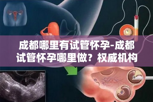 成都哪里有试管怀孕-成都试管怀孕哪里做?权威机构推荐 成都哪里有试管怀孕-成都试管怀孕哪里做?权威机构推荐