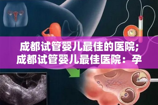 成都试管婴儿最佳的医院;成都试管婴儿最佳医院:孕育新生命的摇篮 成都试管婴儿最佳的医院;成都试管婴儿最佳医院:孕育新生命的摇篮