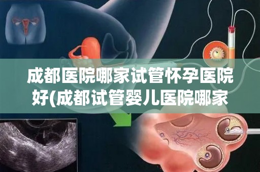 成都医院哪家试管怀孕医院好(成都试管婴儿医院哪家口碑好?) 成都医院哪家试管怀孕医院好(成都试管婴儿医院哪家口碑好?)