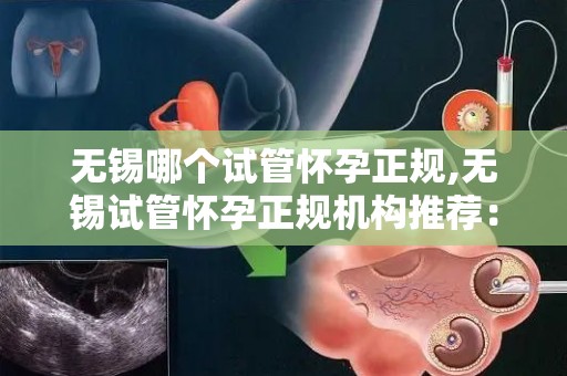 无锡哪个试管怀孕正规,无锡试管怀孕正规机构推荐：助您孕育新生命